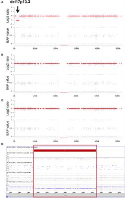 Detection of Disease-Causing SNVs/Indels and CNVs in Single Test Based on Whole Exome Sequencing: A Retrospective Case Study in Epileptic Encephalopathies